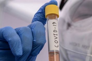 Vigilância Sanitária testa idosos e funcionários de clínica