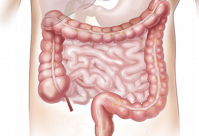 Departamento de Saúde de Paraguaçu alerta: virose é transmitida pela via fecal-oral, por transmissão direta 