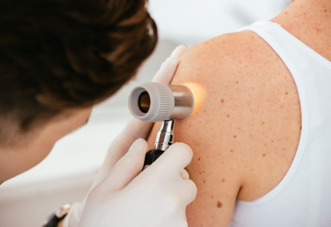 Santa Casa, em parceria com a Prefeitura Municipal, promove Mutirão de Dermatologia a partir de segunda-feira, dia 28